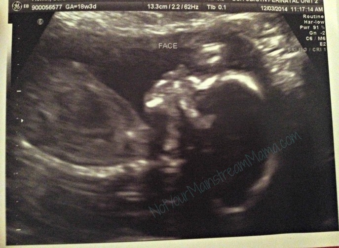 18 week ultrasound pic